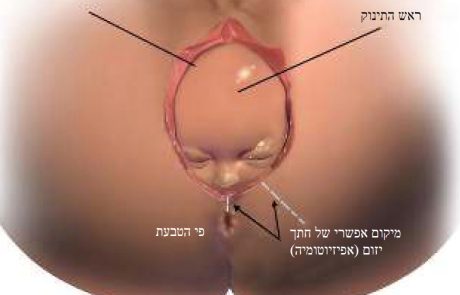 דף מידע בנושא הפגיעה האפשרית ברצפת האגן במהלך הריון ולידה