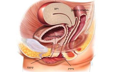 דף מידע בנושא תיקון הדופן הקדמית של הנרתיק